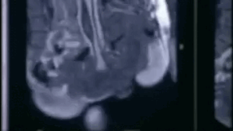 Une pénétration vaginale visualisée avec un IRM